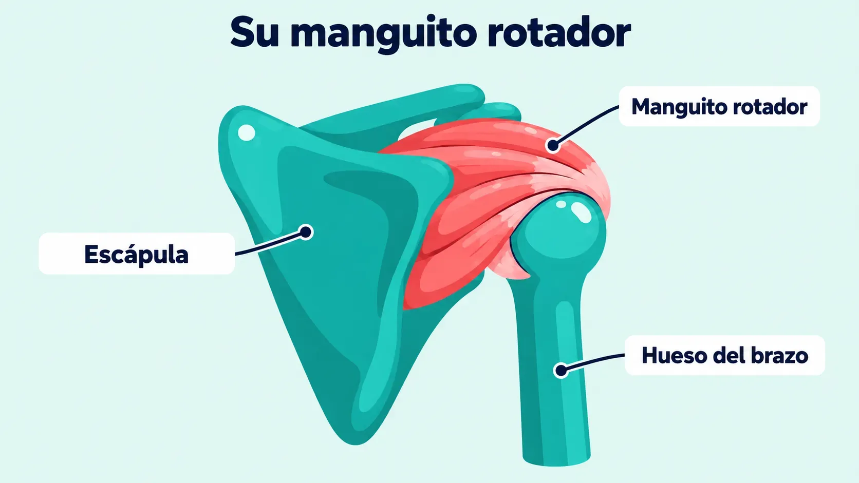 Diagrama de la parte posterior del hombro derecho con el manguito rotador, una banda de músculo y tendón que va de la escápula hasta la cabeza redonda del hueso del brazo